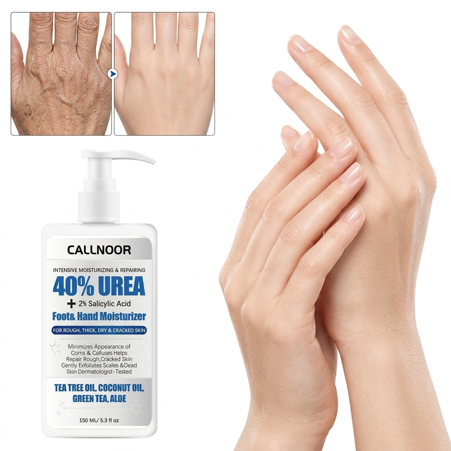 Urea Foot Cream - 0% Urea Hand Foot Cream 2%