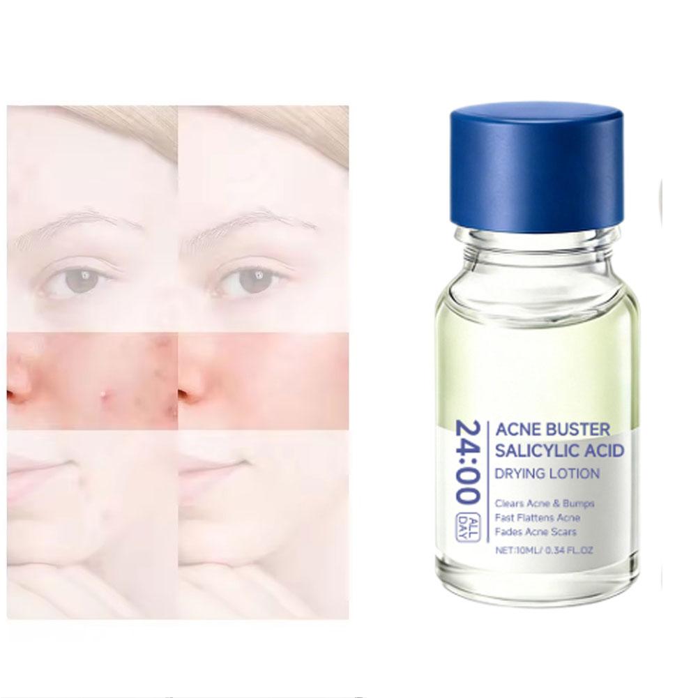 Salicylic Acid Essence Treatme - Hyaluronic Acid Serum 评论和价格