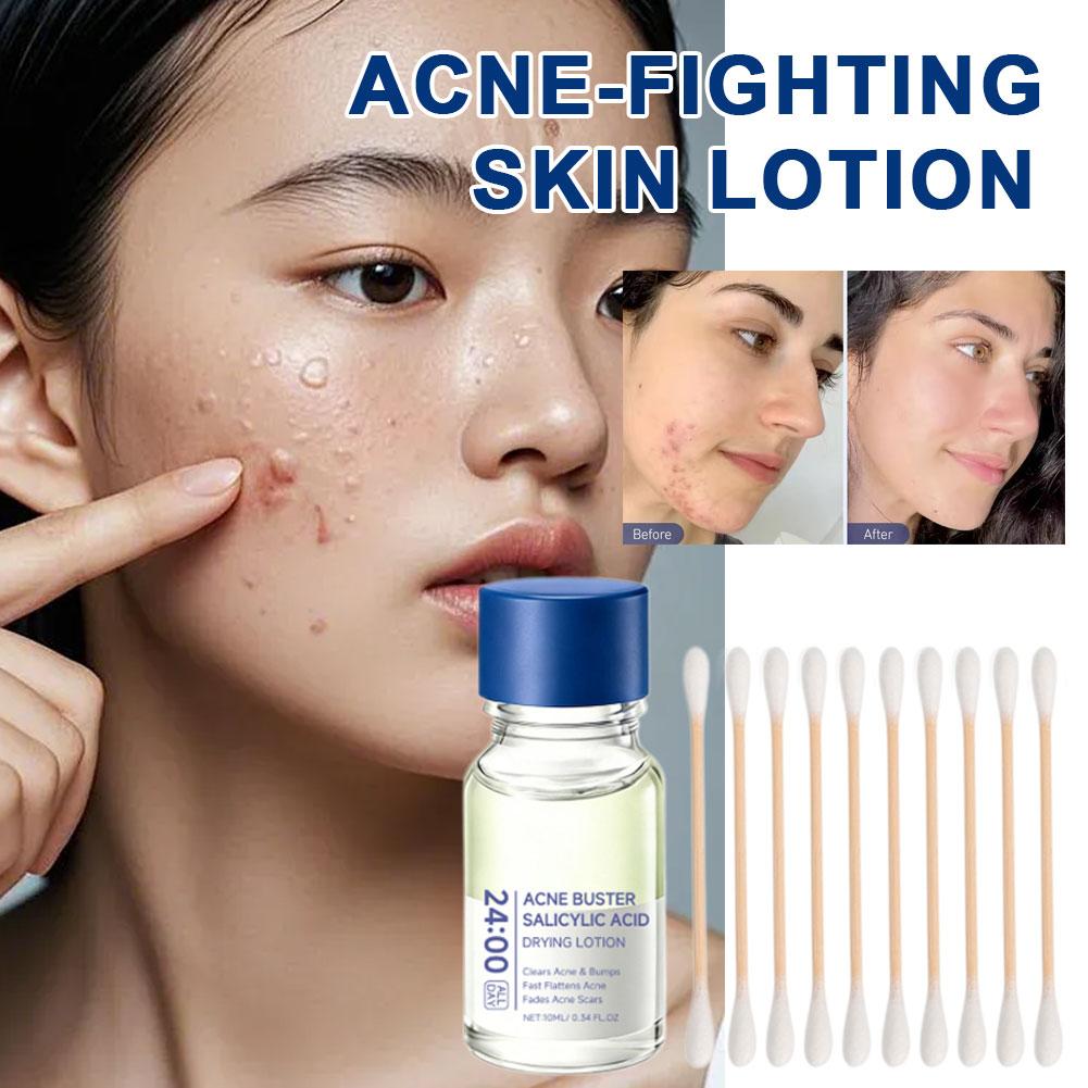 Salicylic Acid Essence Treatme - Hyaluronic Acid Serum 评论和价格
