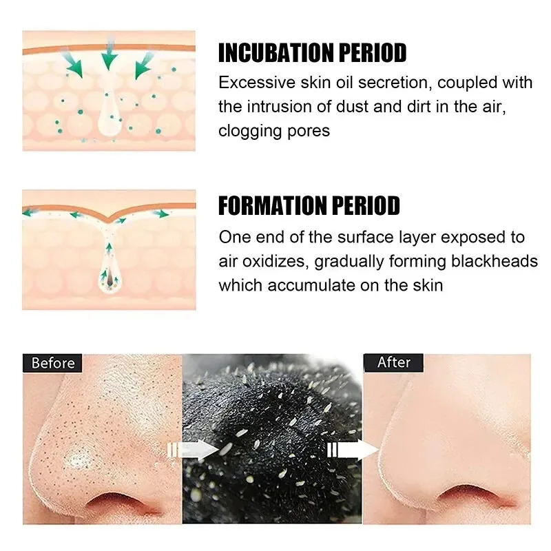 10/150PCS Blackhead Remove Mas - Skincare Viral Tiktok 评论和价格